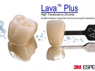 Răng sứ lava 3M